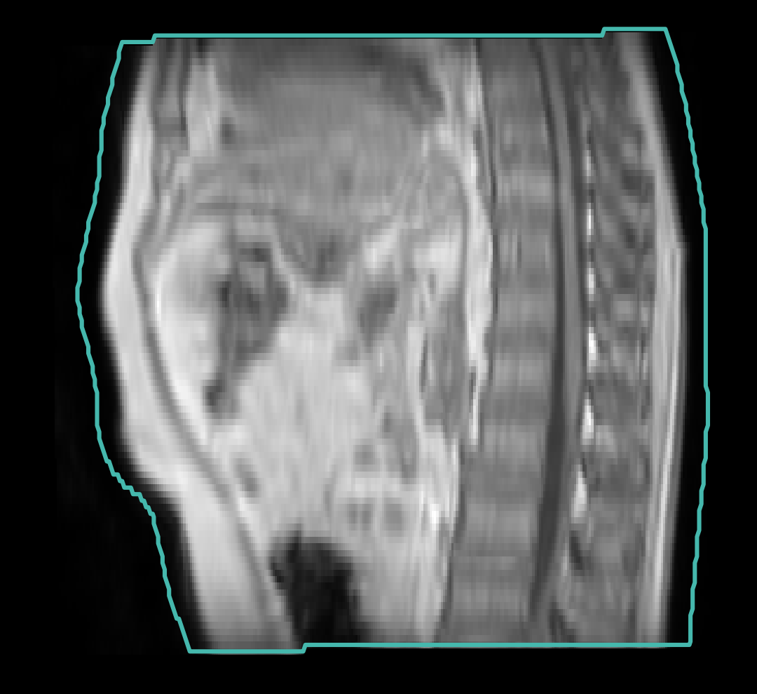 Sagittal MRI of SynthRAD2025 abdomen case 1ABA033 with the body-mask contour